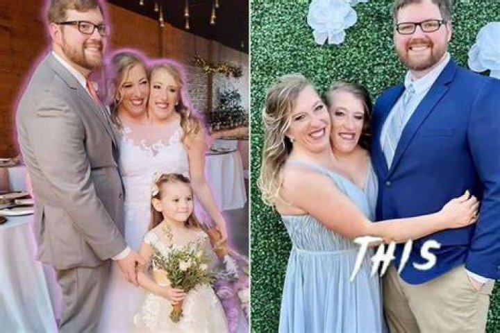 Abby and Brittany Hensel: Celebrating Their Extraordinary Lives After the Heartbreaking News