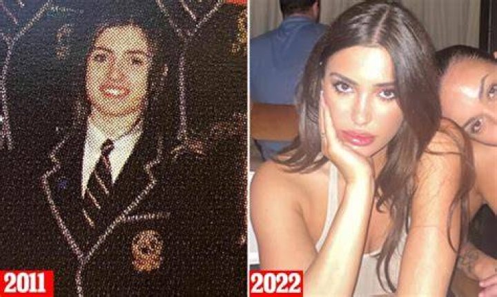 Bianca Censori Plastic Surgery: A Comprehensive Guide to Transformative Procedures
