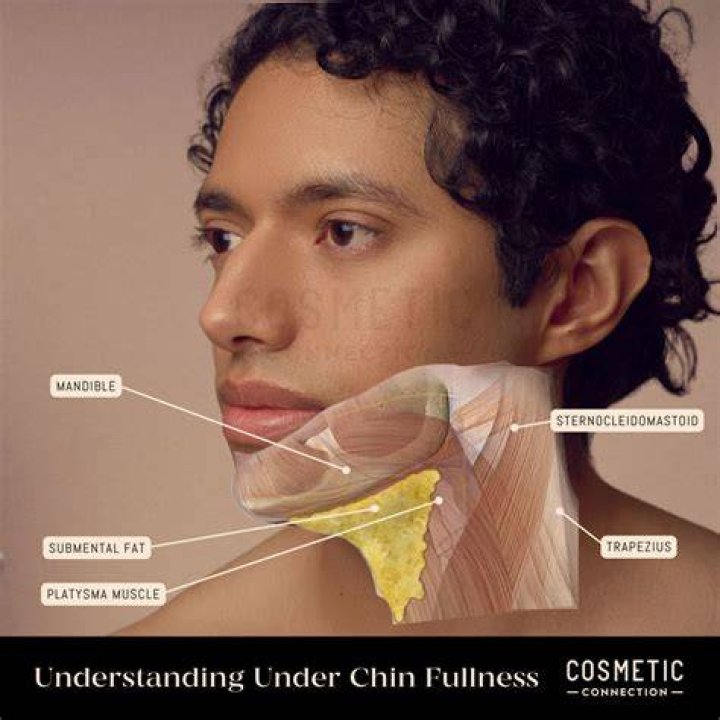 Chin Indentation: The Ultimate Guide to Understanding, Achieving, and Enhancing Your Jawline