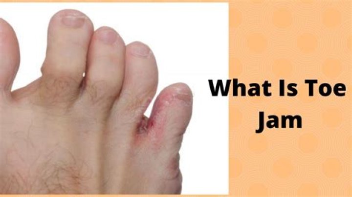 Discover the Fascinating World of Toe Jam Pictures: Insights and Analysis