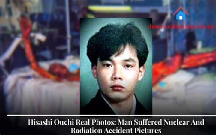 Hisashi Ouchi: The Untold Story and Real Photo Collection