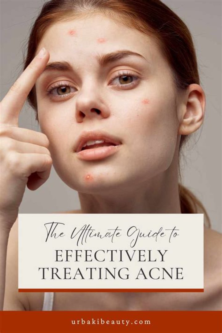 Is Ice Good for Pimples? The Ultimate Guide to Treating Acne Naturally