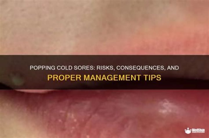 Is Popping Cold Sores Bad? Understanding the Risks and Proper Care