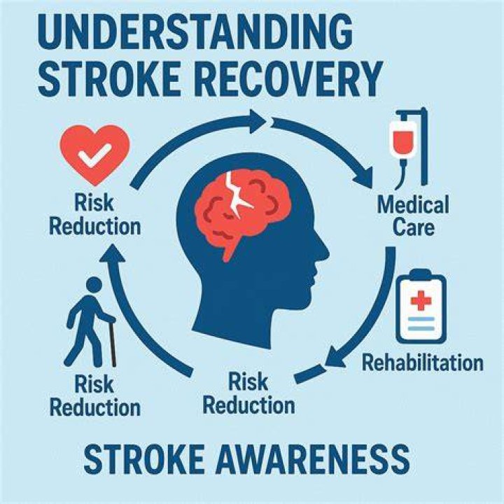 Kevin Whatley's Stroke: Understanding the Journey, Impact, and Recovery
