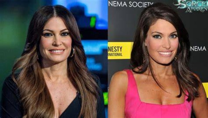 Kimberly Guilfoyle Before and After: The Remarkable Transformation