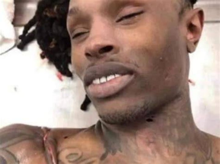 King Von Autopsy Photo: A Detailed Examination of the Late Artist's Legacy