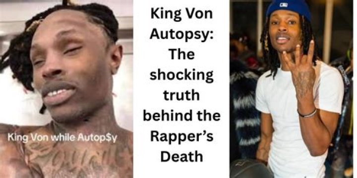 King Von Autopsy Picture: Unveiling the Truth Behind the Late Artist's Legacy