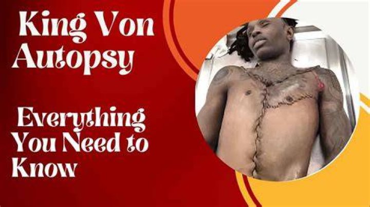 King Von Autopsy Report: A Comprehensive Analysis
