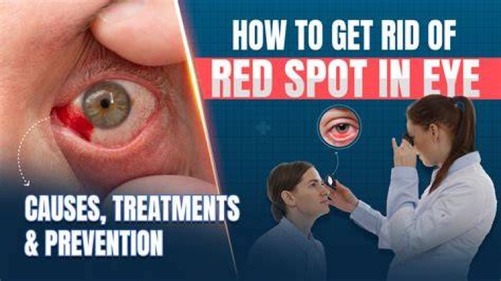 Red Bump Below Eye: Causes, Treatments, and Prevention Tips