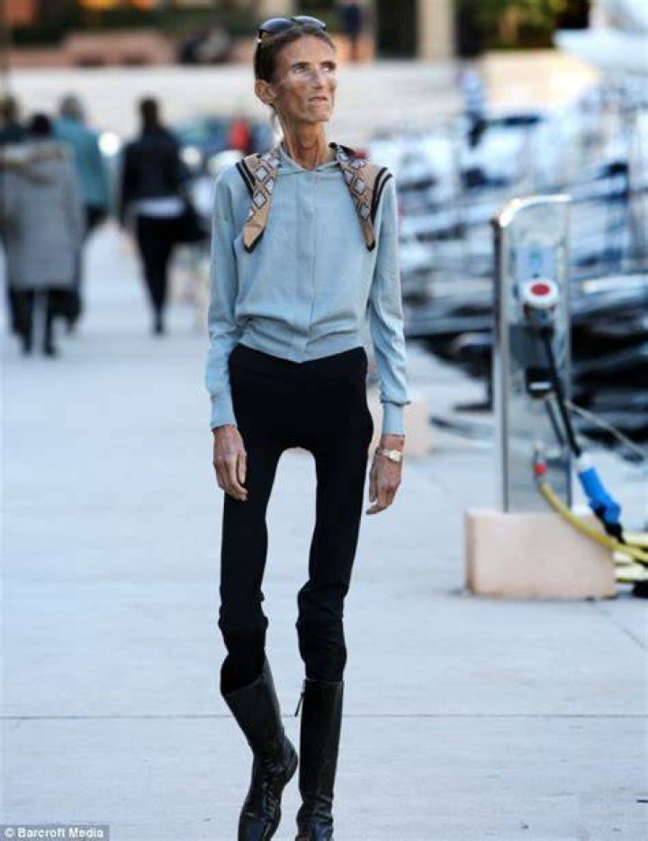 The Thinnest Person in the World: A Journey Through Health, Science, and Humanity