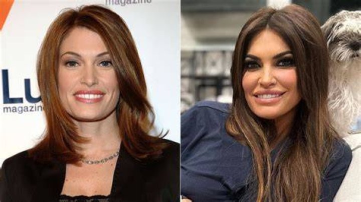 What Did Kimberly Guilfoyle Do to Her Face? A Comprehensive Analysis