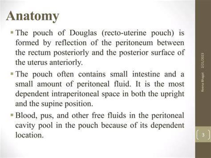 What is a Pouch of Douglas: A Comprehensive Guide to Understanding the Cul-de-sac of the Peritoneum